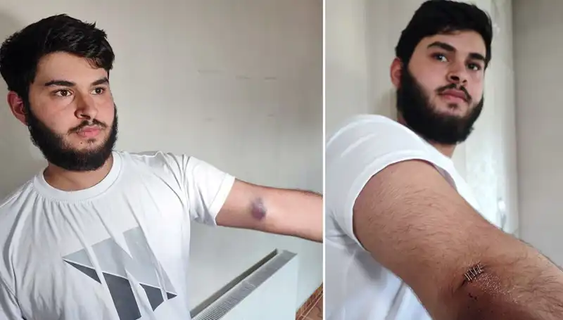 Bahçeye Kaçan Top Mahalleyi Sarsan Olayı Başlattı!